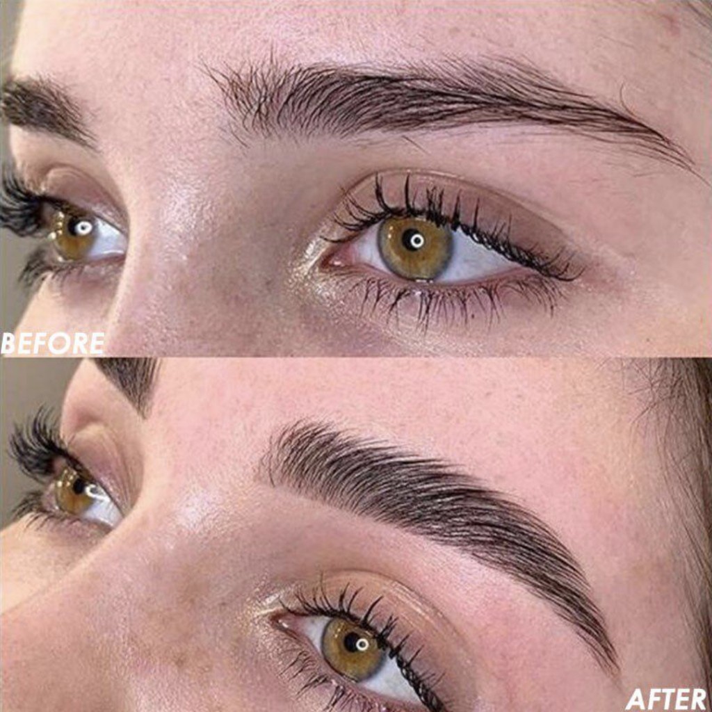 Formation Browlift