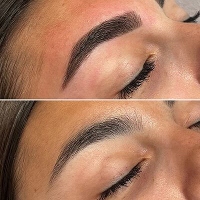 Formation Browlift